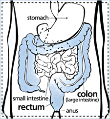 Colorectal Cancer